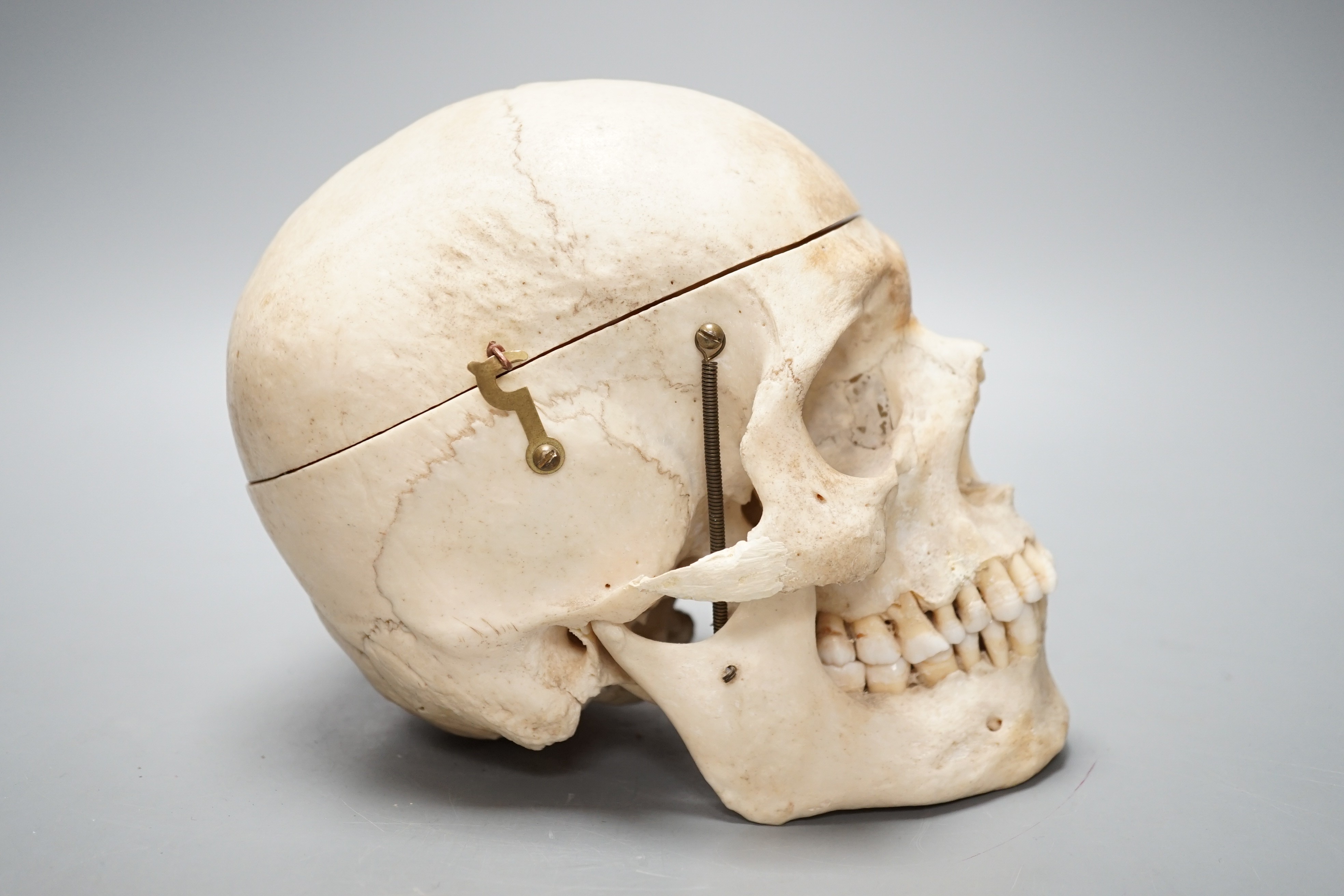 A human skull with removable cranium and spring loaded jaw 15.5cm